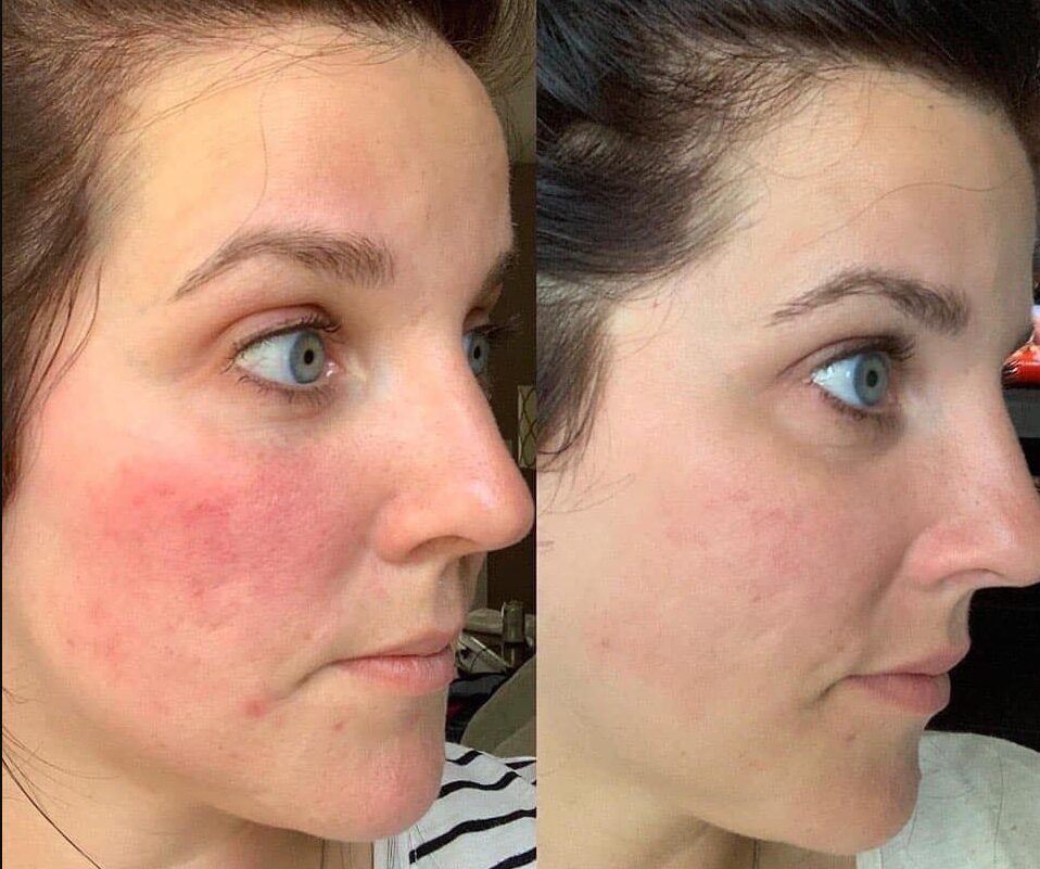 Avant / Après — Marion, 34 ans
