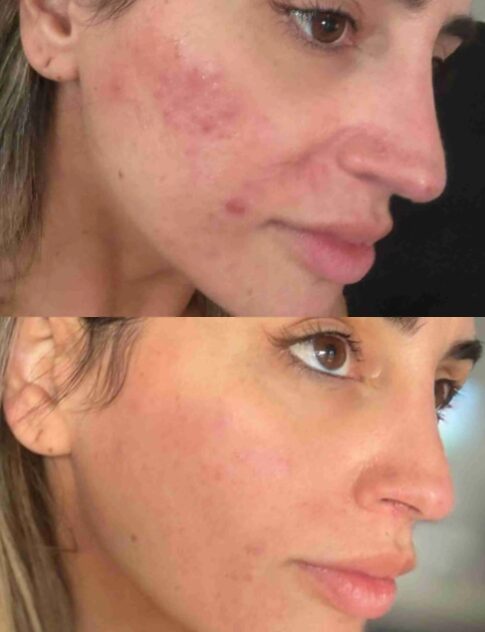Avant / Après — Sofia, 31 ans
